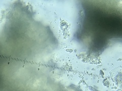 Arthonia patellulata