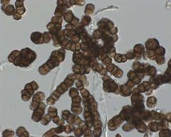 Trimmatostroma salicis