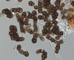 Trimmatostroma salicis