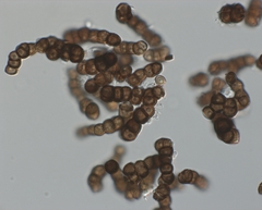 Trimmatostroma salicis