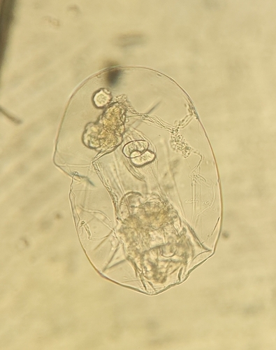 Asplanchna