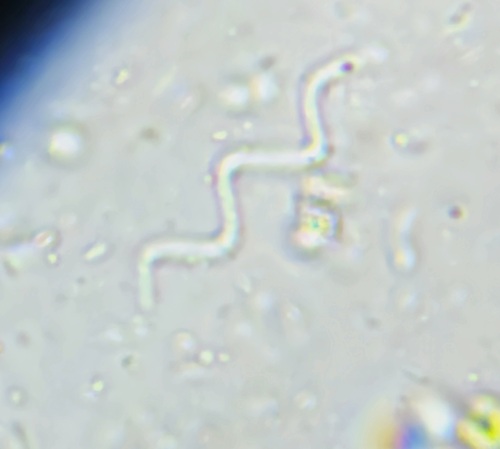 Spirulina observed 2026-07-21