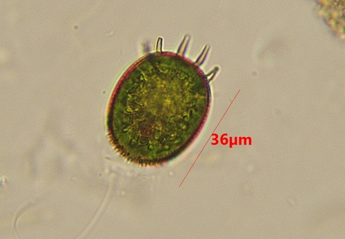 Trachelomonas armata steinii