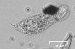 Gastrotricha