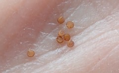 Stellaria apetala