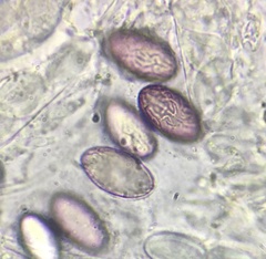 Ascobolus albidus