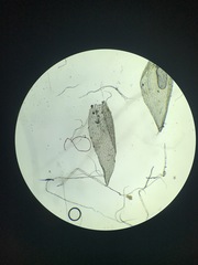 Sphagnum platyphyllum