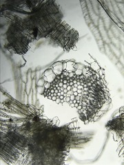 Sphagnum platyphyllum