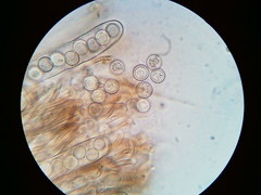 Pseudoplectania vogesiaca