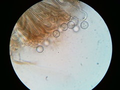 Pseudoplectania vogesiaca