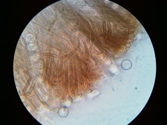 Pseudoplectania vogesiaca