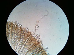 Pseudoplectania vogesiaca