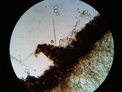 Pseudoplectania vogesiaca