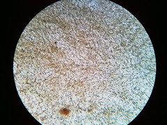 Pseudoplectania vogesiaca