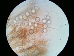 Pseudoplectania vogesiaca