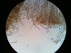 Pseudoplectania vogesiaca