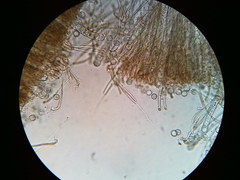 Pseudoplectania vogesiaca