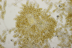 Puccinia arenariae