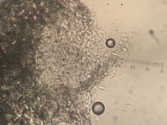 Arthonia punctiformis