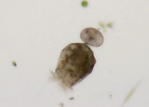Brachionus angularis bidens