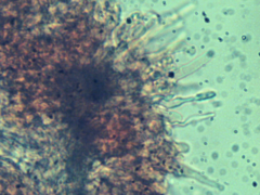 Hyphodontia arguta