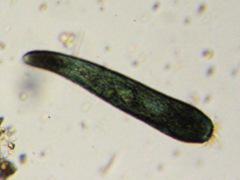 Stentor multiformis