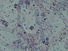 Tomentellopsis echinospora