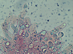 Tomentellopsis echinospora