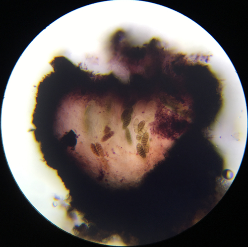 Purpurepithecium minus