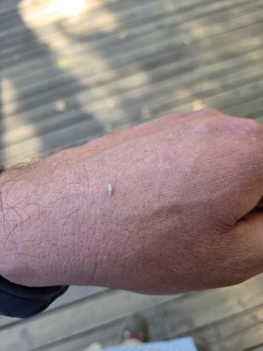 iNaturalist observation photo of True Bugs, Hoppers, Aphids, and allies