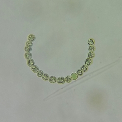 Anabaena