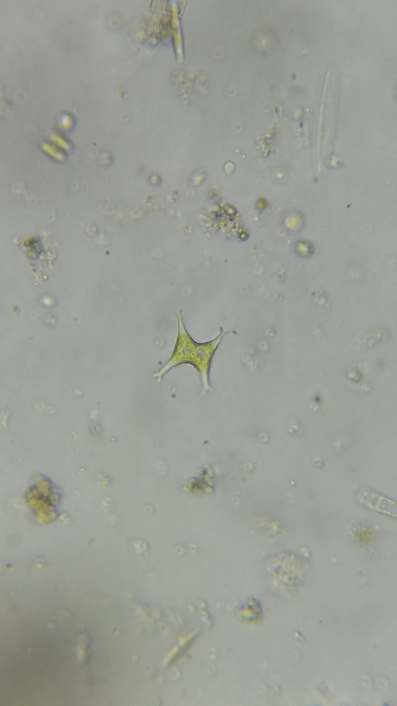 Pseudostaurastrum hastatum