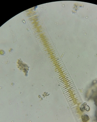 Fragilaria