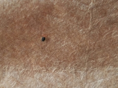 Balaustium