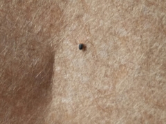 Balaustium