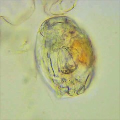 Lecane closterocerca