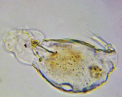 Lecane closterocerca