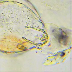 Lecane closterocerca