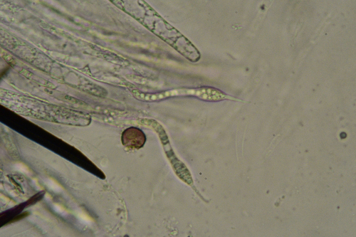 Lasiosphaeris hirsuta