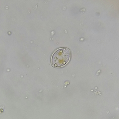 Cocconeis