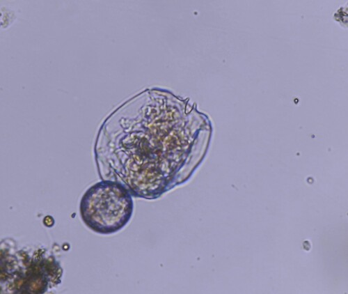 Brachionus angularis