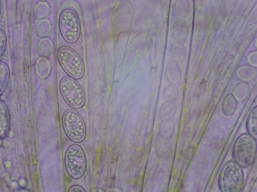Scutellinia