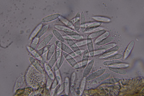 Sphaerellopsis
