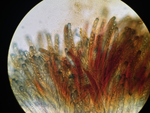Rugosporella atrovinosa