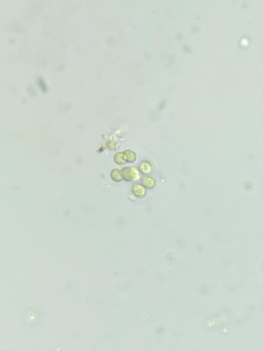Limnococcus limneticus observed 2026-07-15