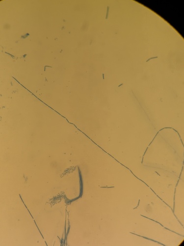 Akanthomyces