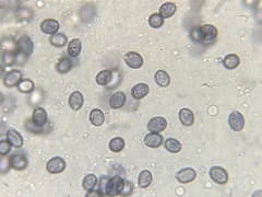 Melanoleuca longisterigma