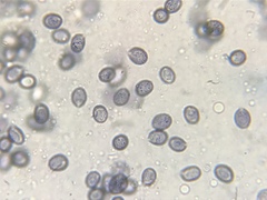 Melanoleuca longisterigma