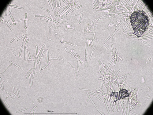 Ramularia pratensis