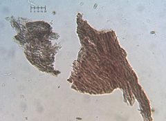 Chaenothecopsis debilis